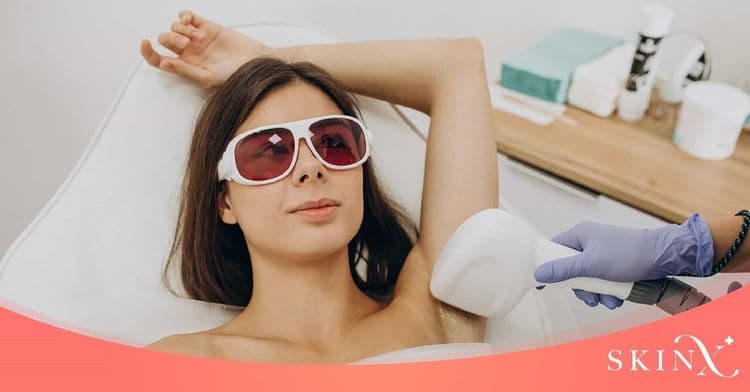 “เลเซอร์ขน” เพื่อบอกลาเส้นขนแบบถาวร มีกี่แบบ ราคาเท่าไหร่บ้าง