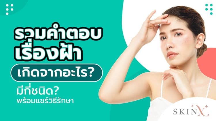 เป็นฝ้าเพราะอะไร? ป้องกันได้ไหม? รักษาได้อย่างไรบ้าง?