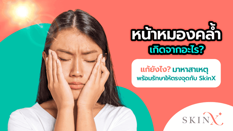 หน้าหมองคล้ำ สีผิวไม่สม่ำเสมอ ทำยังไงดี? ปัญหากวนใจที่แก้ไม่ยาก!