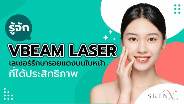 บอกลาปัญหารอยแดงบนใบหน้าด้วย “Vbeam laser”