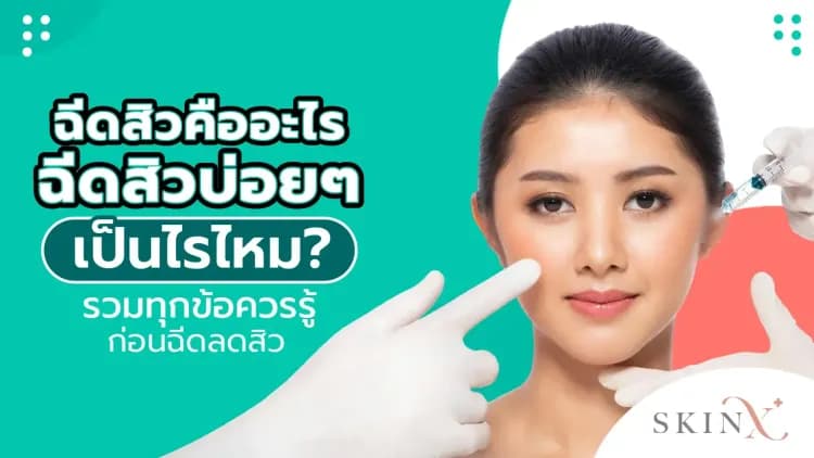 ฉีดสิวคืออะไร ฉีดสิวบ่อย ๆ เป็นไรไหม? รวมทุกข้อควรรู้ก่อนฉีดลดสิว