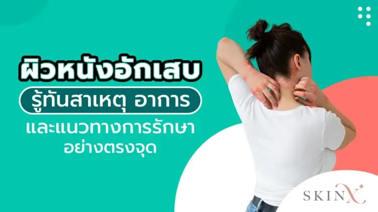 ผิวหนังอักเสบ รู้ทันสาเหตุ อาการ และแนวทางการรักษาอย่างตรงจุด