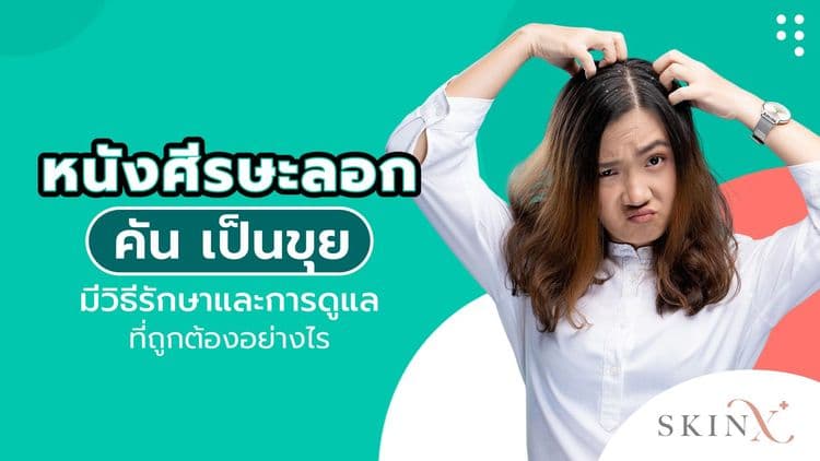 หนังศีรษะลอก คัน เป็นขุย มีวิธีรักษาและการดูแลที่ถูกต้องอย่างไร