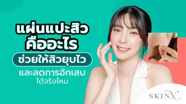 แผ่นแปะสิว คืออะไร ช่วยให้สิวยุบไว และลดการอักเสบได้จริงไหม