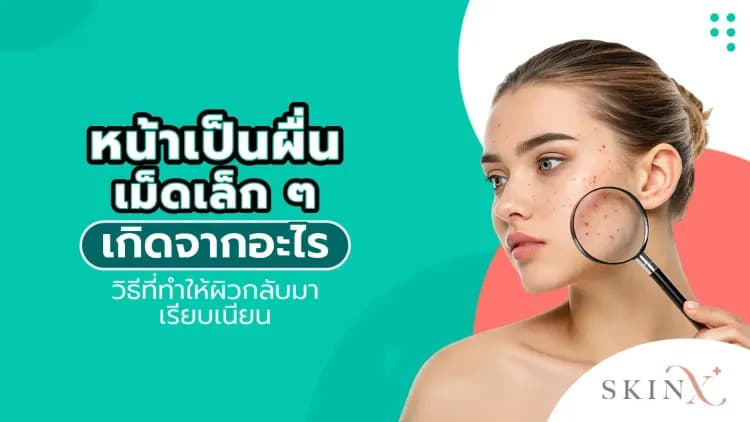 หน้าเป็นผื่นเม็ดเล็ก ๆ เกิดจากอะไร วิธีที่ทำให้ผิวกลับมาเรียบเนียน
