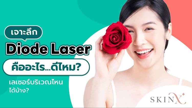 Diode Laser เลเซอร์กำจัดขน นวัตกรรมเลเซอร์ที่อ่อนโยนต่อผิว