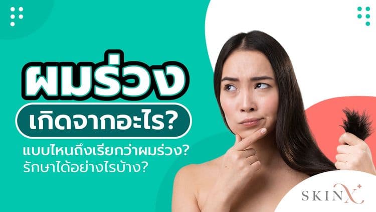ผมร่วงเยอะมาก ปัญหาเส้นผมที่ควรรีบแก้ก่อนผมบาง ร่วงหมดหัว