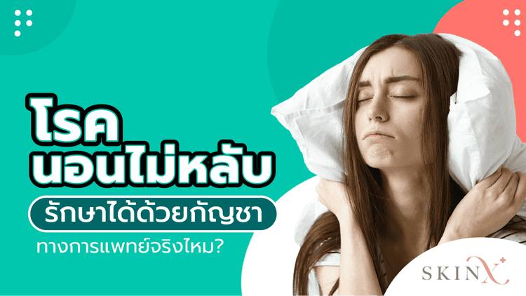 “นอนไม่หลับ” รักษาได้ด้วยกัญชาทางการแพทย์