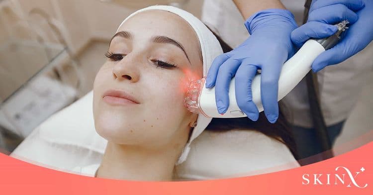 “Q-Switch laser” ตัวช่วยลบรอยสัก รักษาฝ้า กระ และจุดด่างดำ