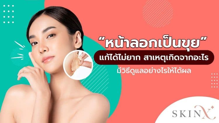 หน้าลอกเป็นขุย หน้าลอกเป็นแผ่น ดูแลรักษาอย่างไรดี? มีสาเหตุมาจากอะไร?