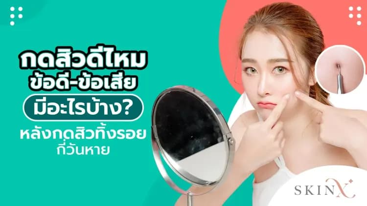 กดสิวดีไหม ข้อดี-ข้อเสียมีอะไรบ้าง หลังกดสิวทิ้งรอยกี่วันหาย