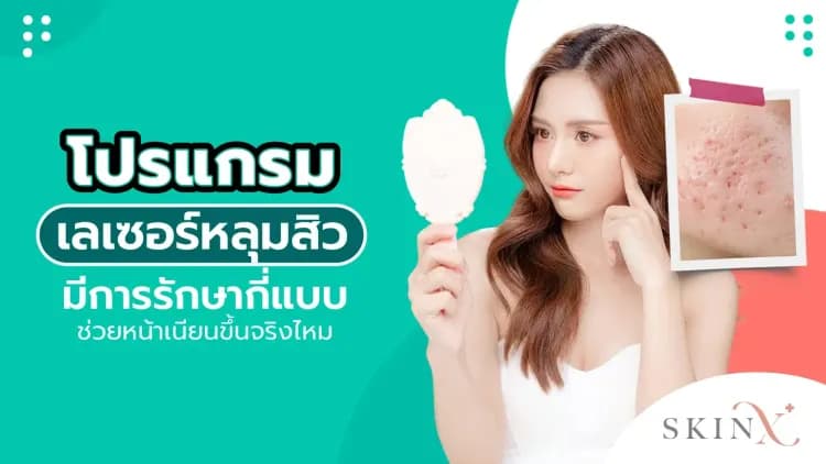 โปรแกรมเลเซอร์หลุมสิว มีการรักษากี่แบบ ช่วยหน้าเนียนขึ้นจริงไหม