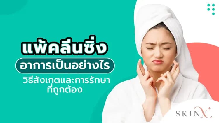 แพ้คลีนซิ่ง อาการเป็นอย่างไร วิธีสังเกตและการรักษาที่ถูกต้อง