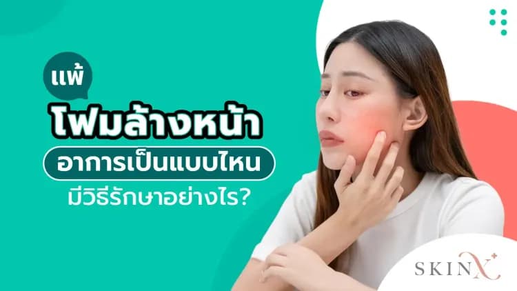 แพ้โฟมล้างหน้าอาการเป็นแบบไหน มีวิธีรักษาอย่างไร?