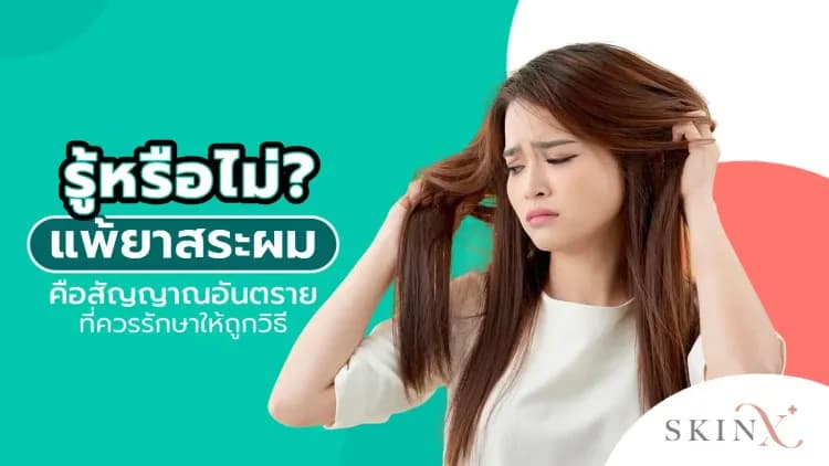 รู้หรือไม่? แพ้ยาสระผมคือสัญญาณอันตรายที่ควรรักษาให้ถูกวิธี