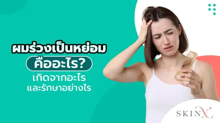 ผมร่วงเป็นหย่อม คืออะไร เกิดจากอะไร และรักษาอย่างไร