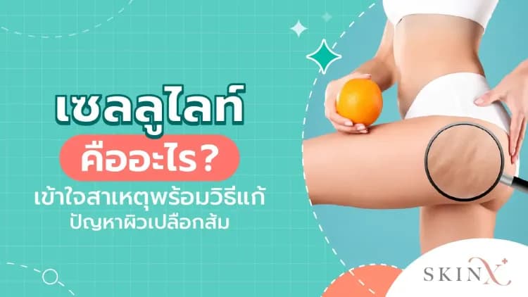 เซลลูไลท์ คืออะไร? เข้าใจสาเหตุพร้อมวิธีแก้ปัญหาผิวเปลือกส้ม