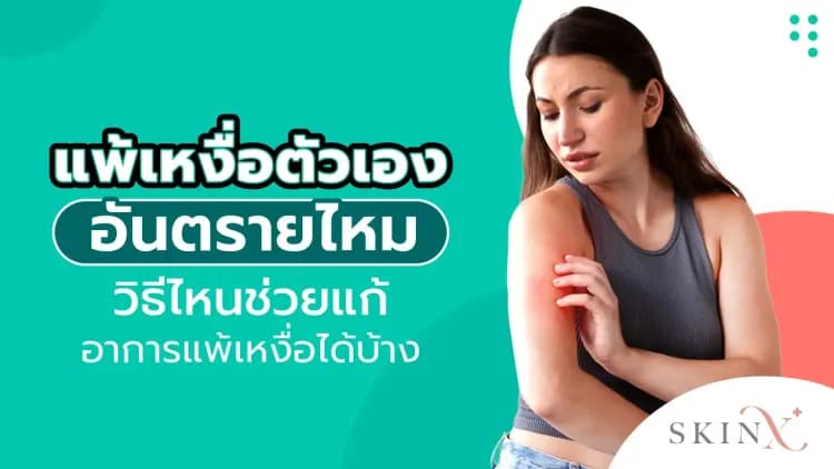 แพ้เหงื่อตัวเองอันตรายไหม วิธีไหนช่วยแก้อาการแพ้เหงื่อได้บ้าง