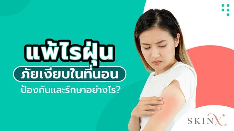 แพ้ไรฝุ่น ภัยเงียบในที่นอน ป้องกันและรักษาอย่างไร?