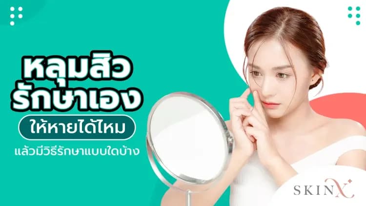 หลุมสิว รักษาเองให้หายได้ไหม แล้วมีวิธีรักษาแบบใดบ้าง