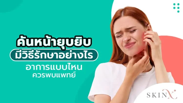 คันหน้ายุบยิบ มีวิธีรักษาอย่างไร อาการแบบไหนควรพบแพทย์