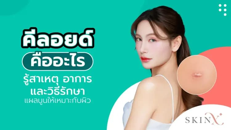 คีลอยด์ คืออะไร รู้สาเหตุ อาการ และวิธีรักษาแผลนูนให้เหมาะกับผิว