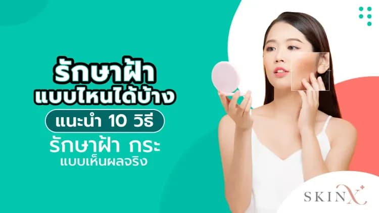 รักษาฝ้าแบบไหนได้บ้าง แนะนำ 10 วิธีรักษาฝ้า กระ แบบเห็นผลจริง