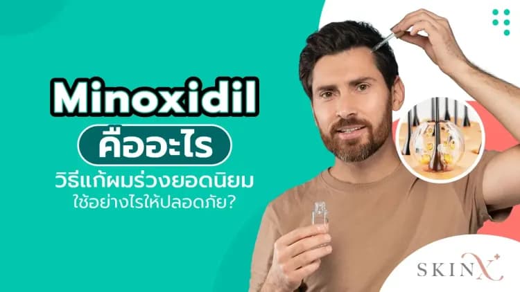 Minoxidil คืออะไร วิธีแก้ผมร่วงยอดนิยม ใช้อย่างไรให้ปลอดภัย?