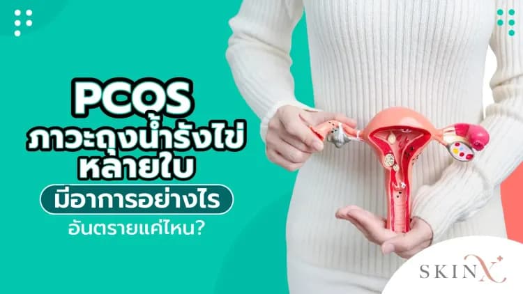 PCOS ภาวะถุงน้ำรังไข่หลายใบ มีอาการอย่างไร อันตรายแค่ไหน?