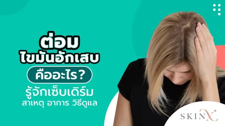 ต่อมไขมันอักเสบ คืออะไร ? รู้จักเซ็บเดิร์ม สาเหตุ อาการ วิธีดูแล