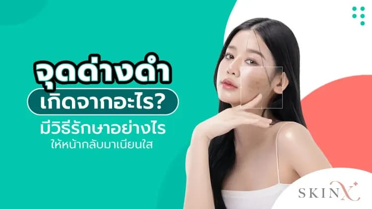 จุดด่างดำ เกิดจากอะไร? มีวิธีรักษาอย่างไร ให้หน้ากลับมาเนียนใส