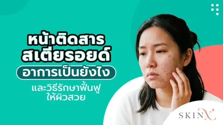 หน้าติดสารสเตียรอยด์ อาการเป็นอย่างไร และวิธีรักษาฟื้นฟูให้ผิวสวย