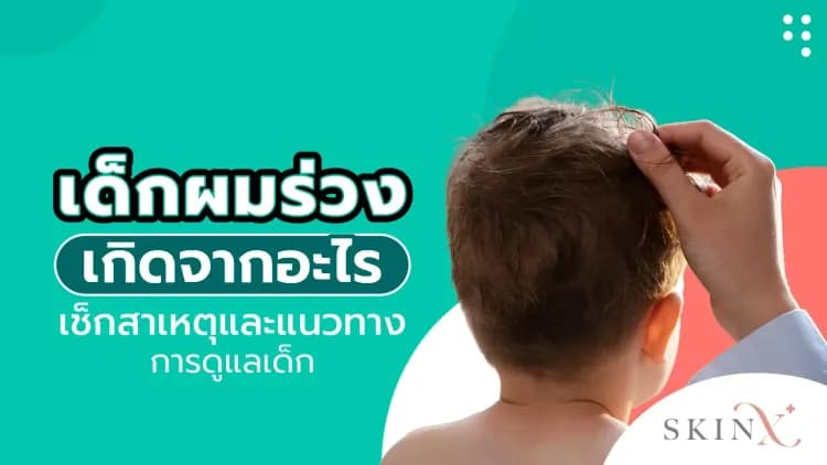 เด็กผมร่วงเกิดจากอะไร เช็กสาเหตุและแนวทางการดูแลเด็ก