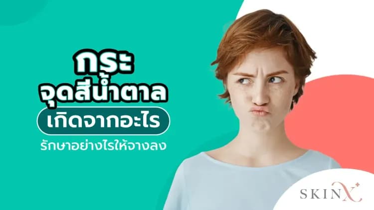 กระ จุดสีน้ำตาล เกิดจากอะไร รักษาอย่างไรให้จางลง