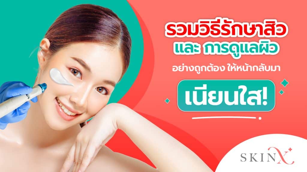 รักษาสิว ทำได้ไม่ยาก! เข้าใจการดูแลผิวอย่างถูกต้อง - SkinX