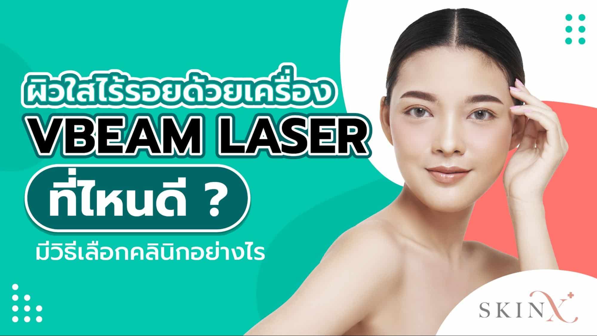 Vbeam laser ที่ไหนดี