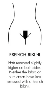 French-Bikini-Laser